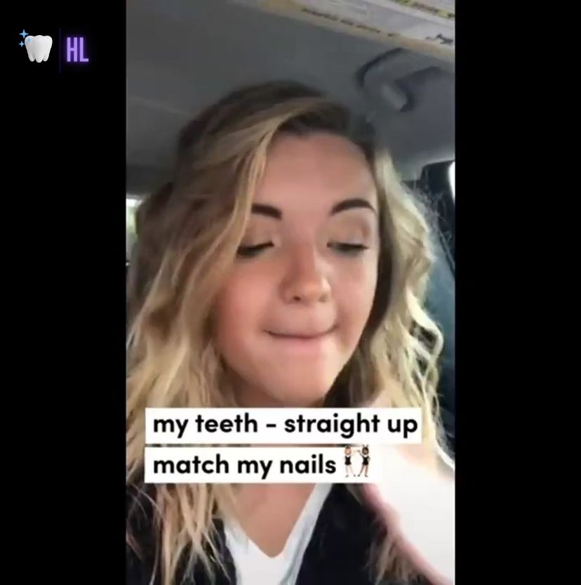 Teeth Whitening Strips - Dental Whitening Strips Video - Amazing results, Amazing New Whiter Teeth